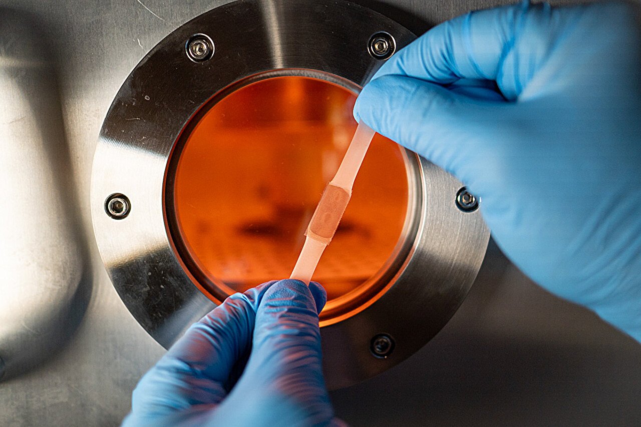 New plasma-based hydrogel tech to speed up recovery for burn victims